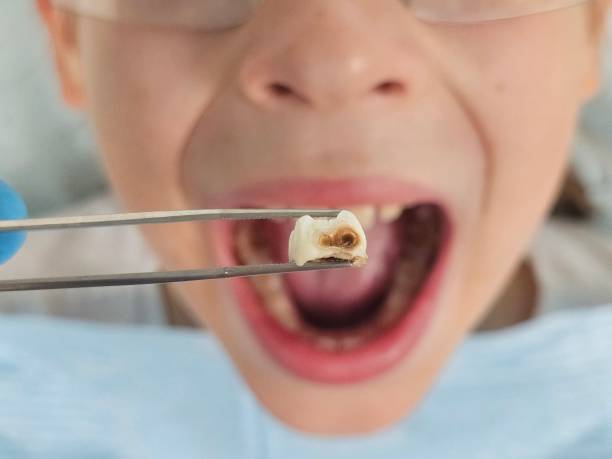 Best Emergency Pediatric Dentist  in Farngton Hills, MI